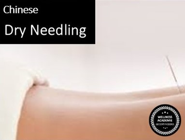 chinese dry-needling eindhoven
